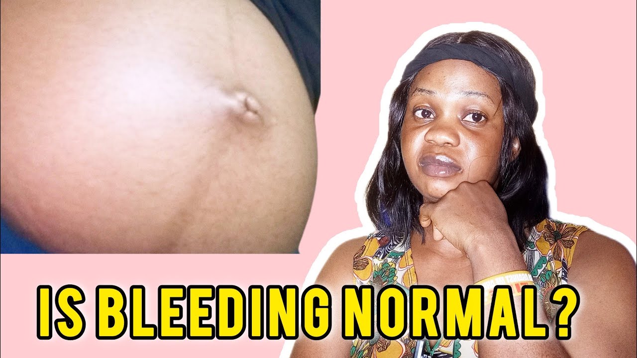 THE DANGERS OF BLEEDING IN PREGNANCY! EVERY PREGNANT MOM SHOULD WATCH THIS
