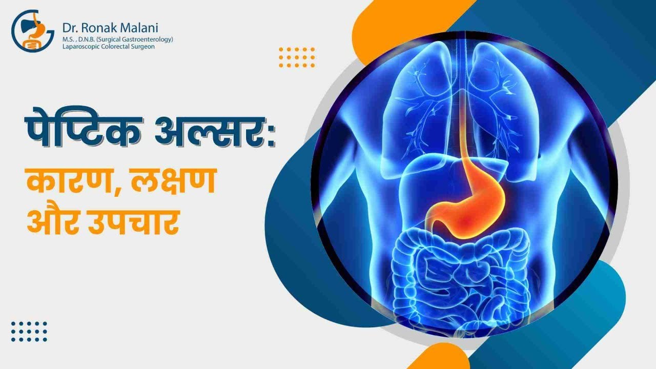 जानिए कैसे एक छोटा सा अल्सर आपके पेट में दर्द को बढ़ा सकता है | Peptic Ulcer: Causes & Symptoms