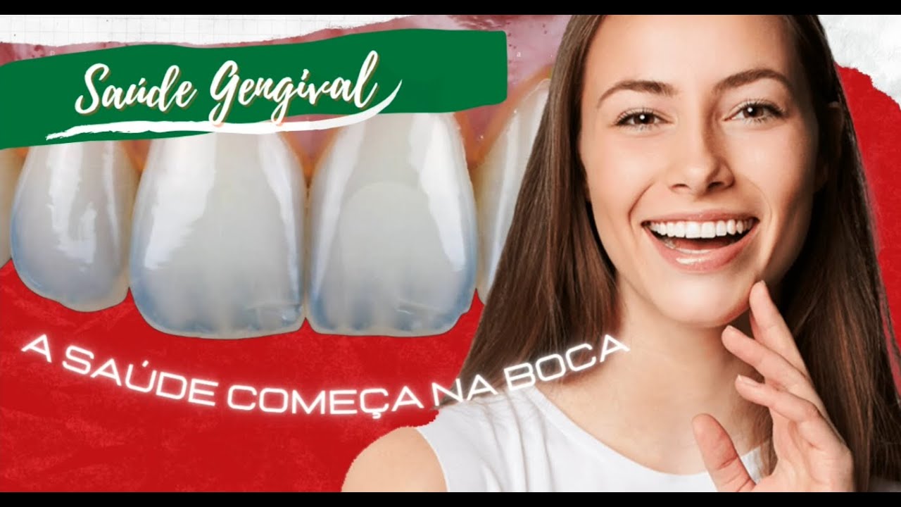 Saúde Gengival (Como ter uma saúde bucal adequada)