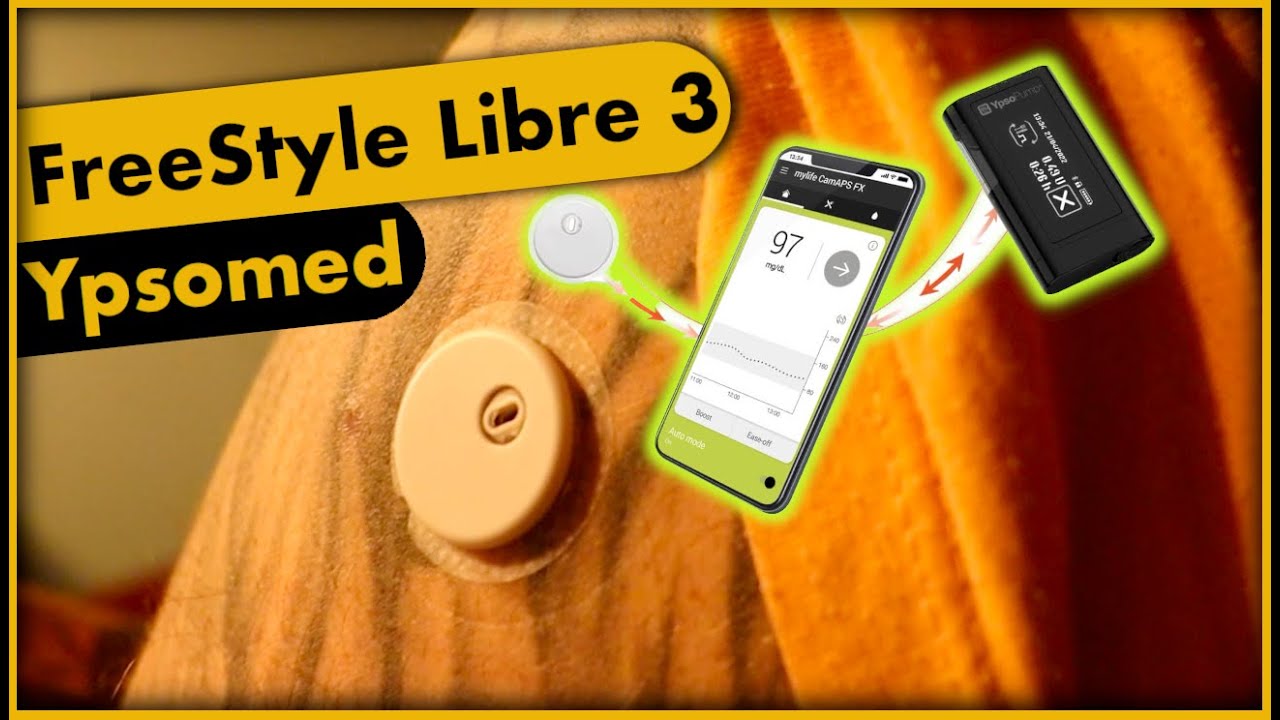 Endlich mit Pumpe   I   Alles zur ersten Loopanbindung des FreeStyle Libre 3