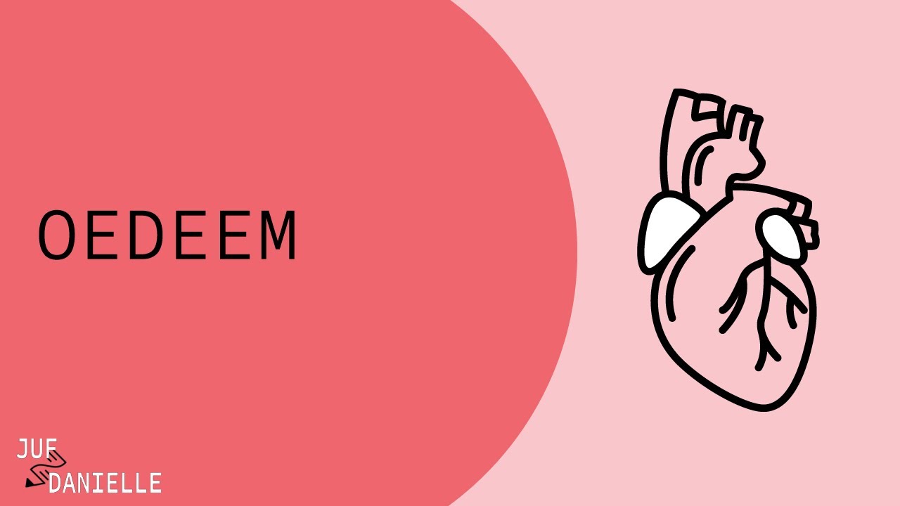 Oedeem