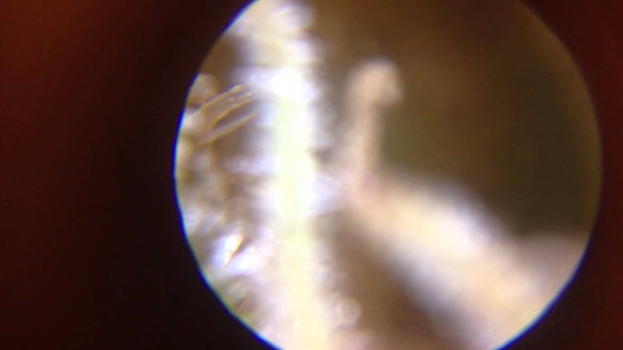 Trichromes cannabis video HD