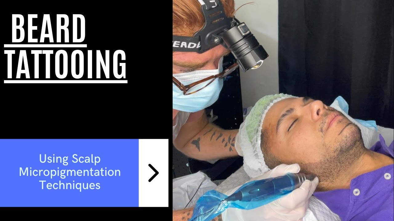 Can Scalp Micropigmentation techniques be used for Beard Tattooing?