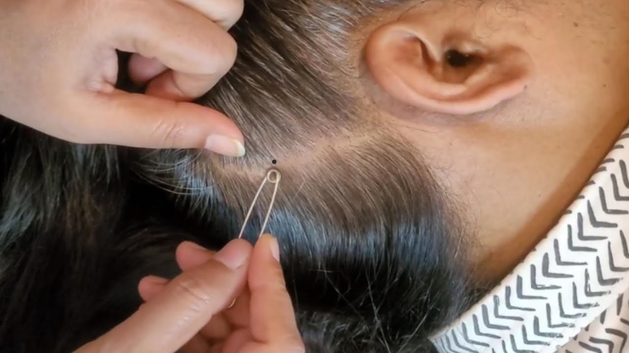 Scalp Check ASMR: The Deep Sleep Experiment