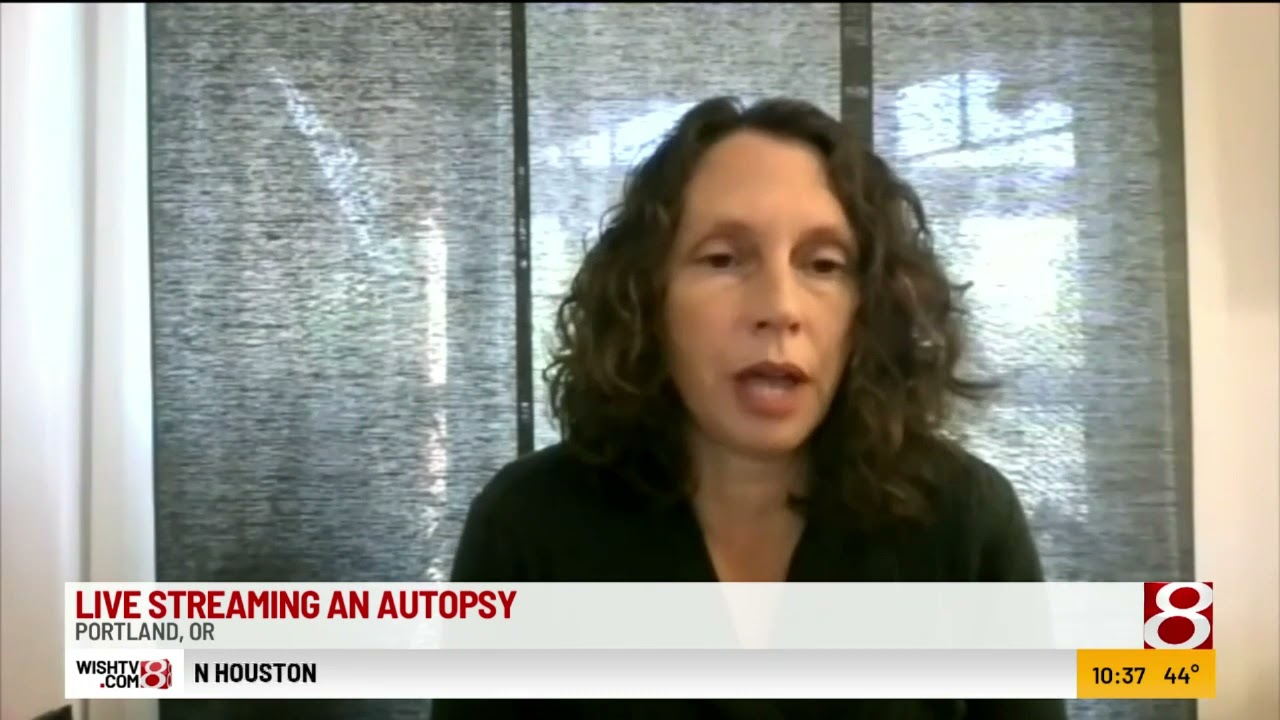 Live autopsy sparks controversy