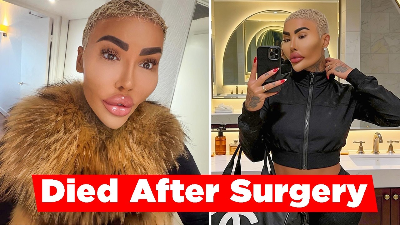 Jordan James Parke Dies After Cosmetic Procedure