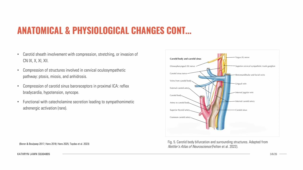 Formative Seminar Presentation : Carotid Body Tumour