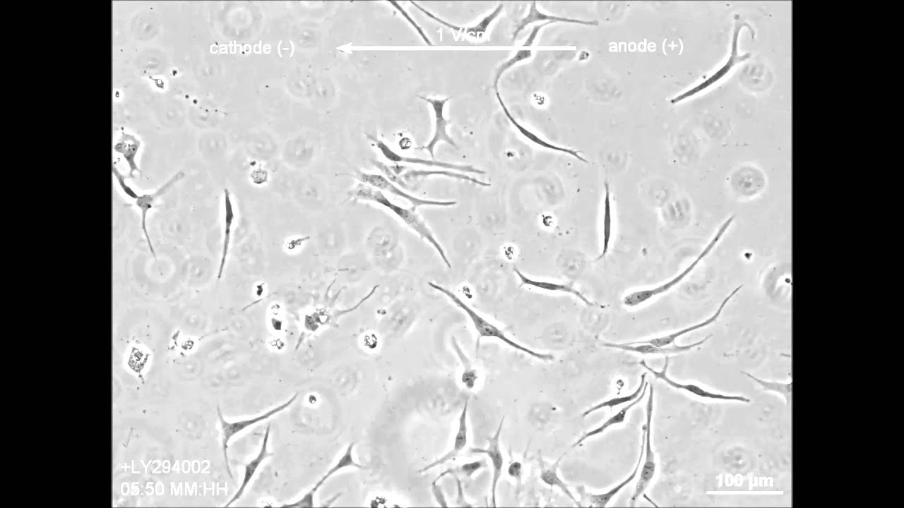 Cellular microenvironment modulates the galvanotaxis of brain tumor initiating cells