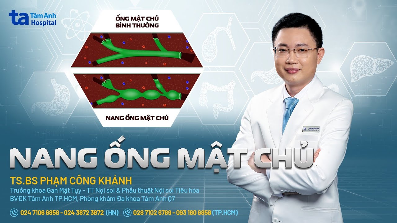 Nang ống mật chủ: Nguyên nhân, triệu chứng, phòng ngừa | TS.BS Phạm Công Khánh | THTA