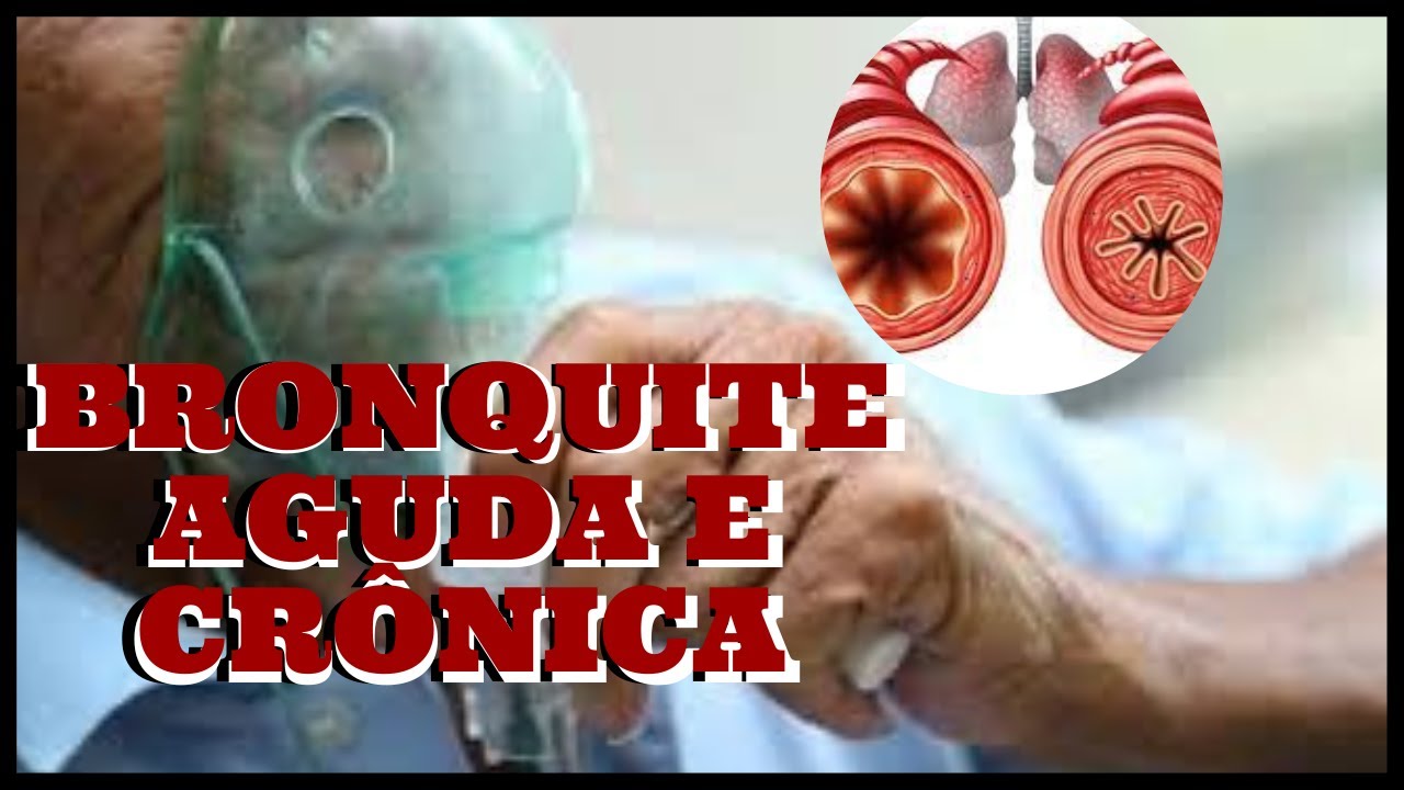 ENTENDA O QUE &Eacute; BRONQUITE AGUDA E CR&Ocirc;NICA