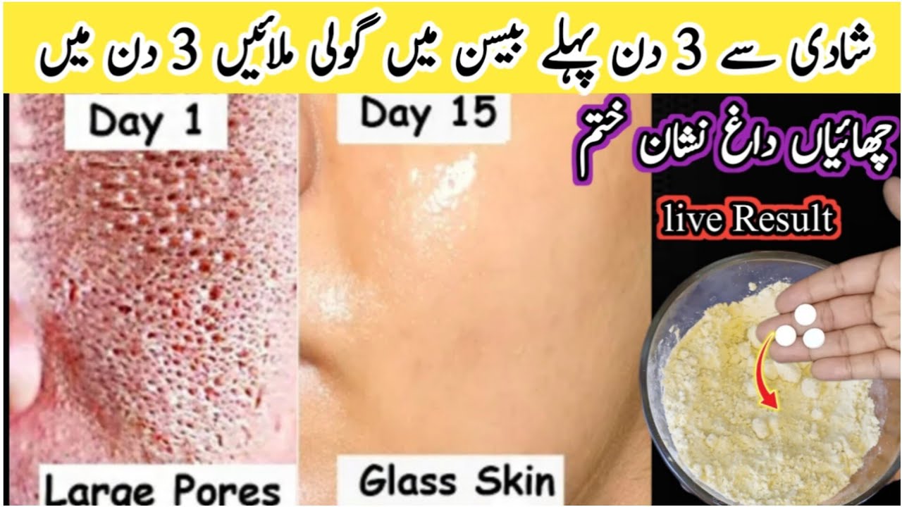 Home Remedy with Besan For Instant Glow || Besan se Rang Gora || Instant Besan Facepack For Glow 