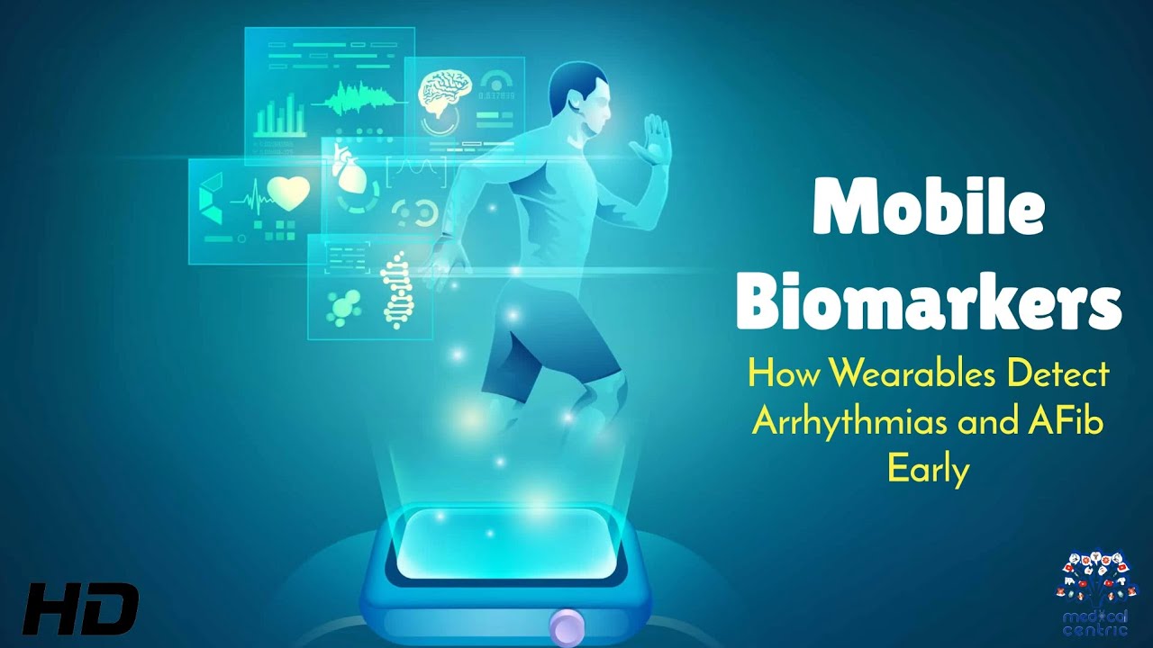 Mobile Biomarkers : How Wearables Detect Arrhythmias and aFib Early