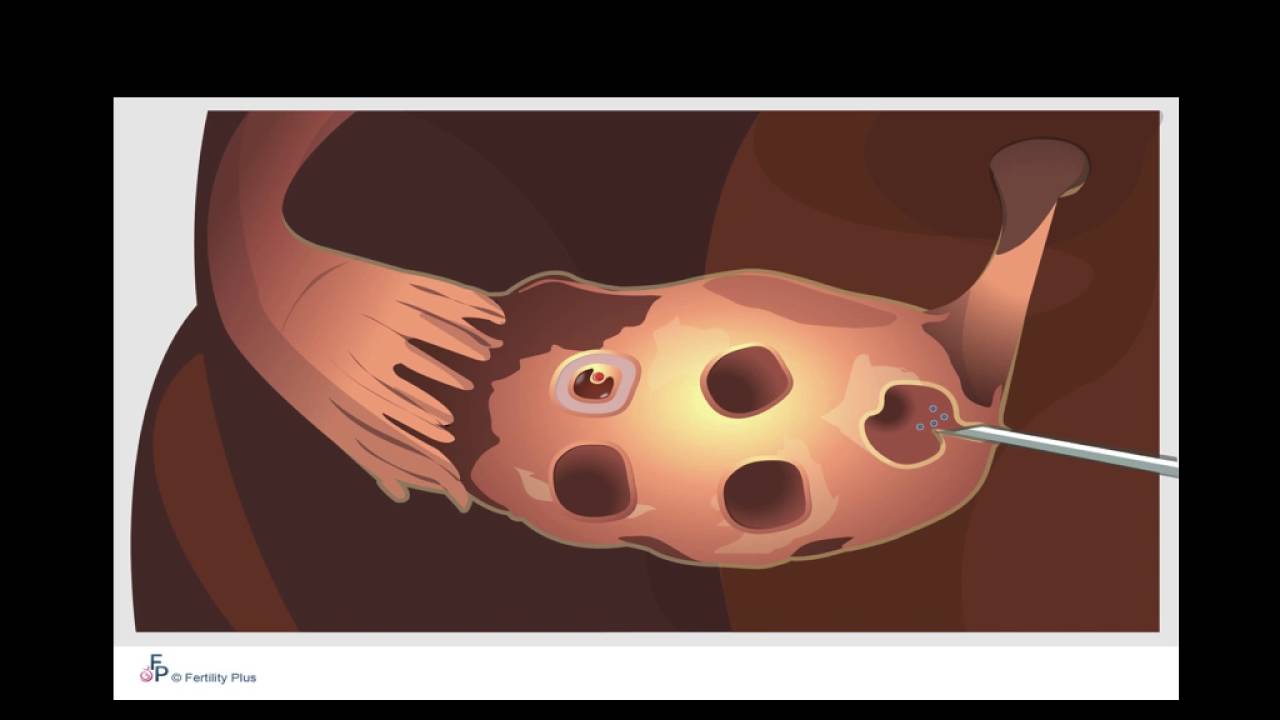 fertility information talk