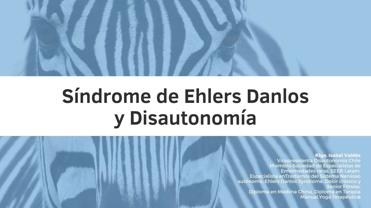 Sindrome de Ehlers Danlos