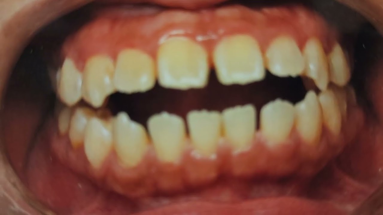 August 26, 2025 -Dr. Pase lor's dificult orthodontic  cases