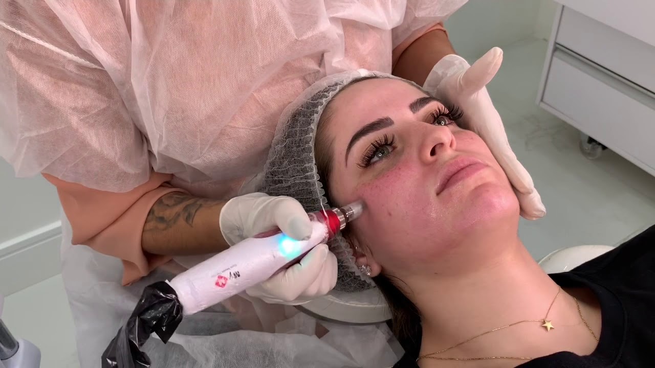 Demonstração completa BB GLOW