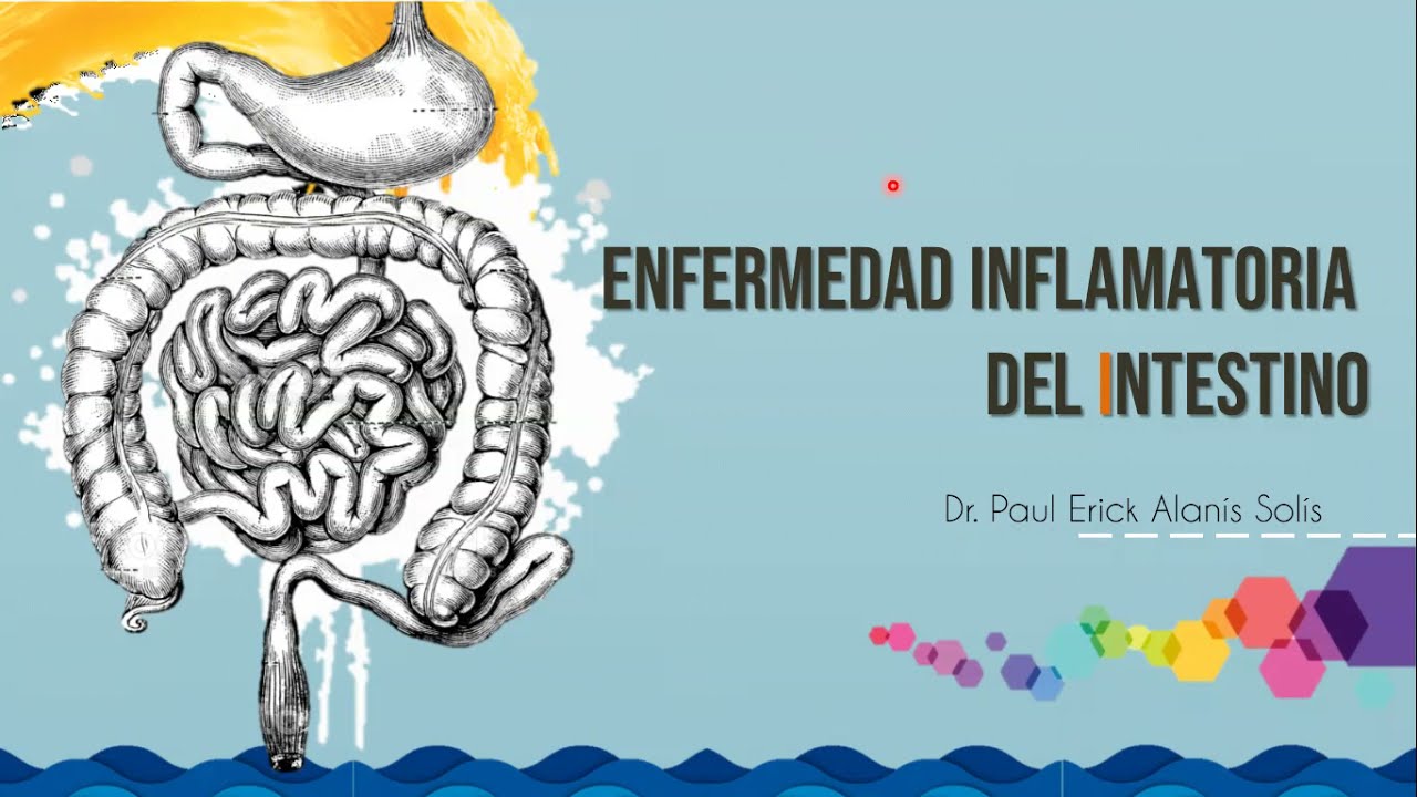 Enfermedad Inflamatoria Intestinal