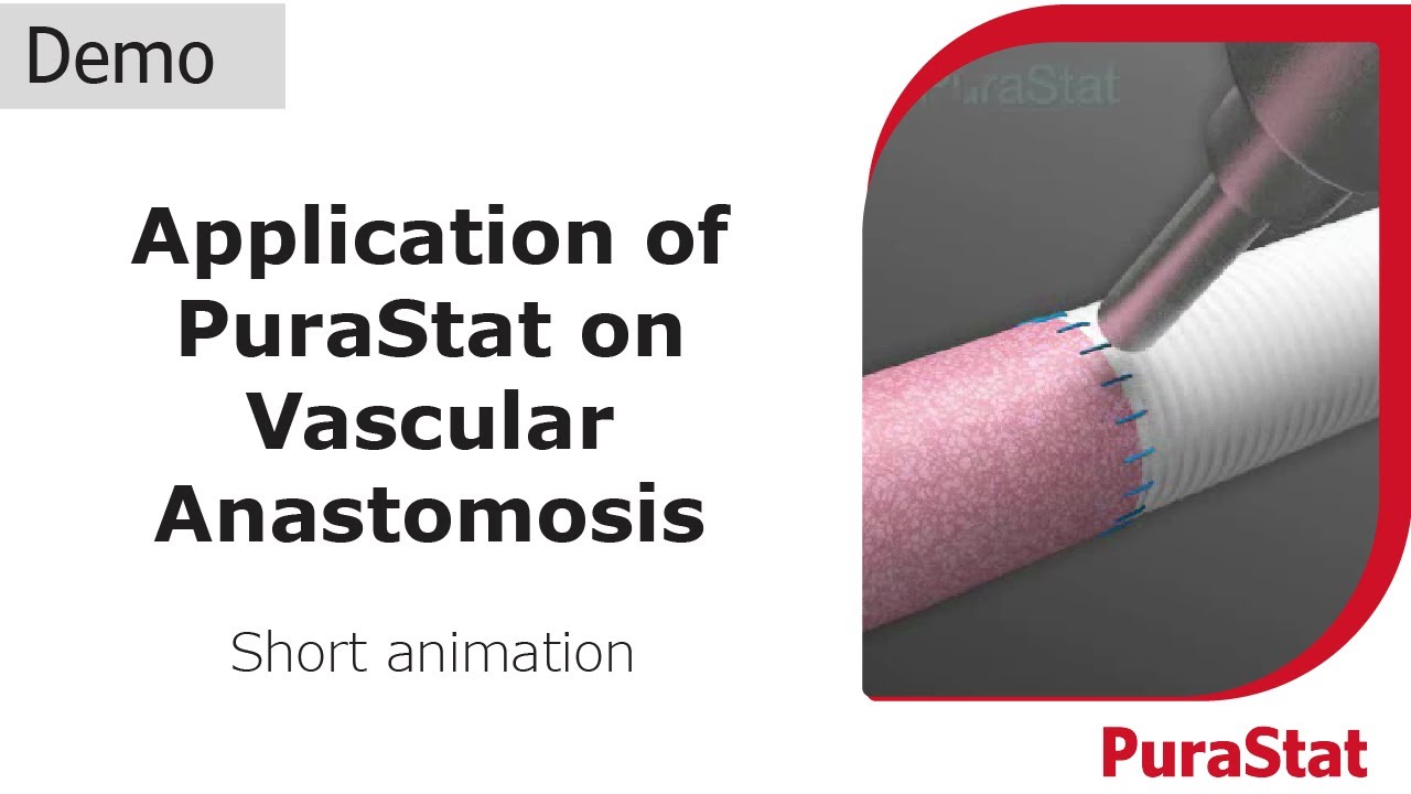 Animated Demonstration of PuraStat Usage on Vascular Anastomosis