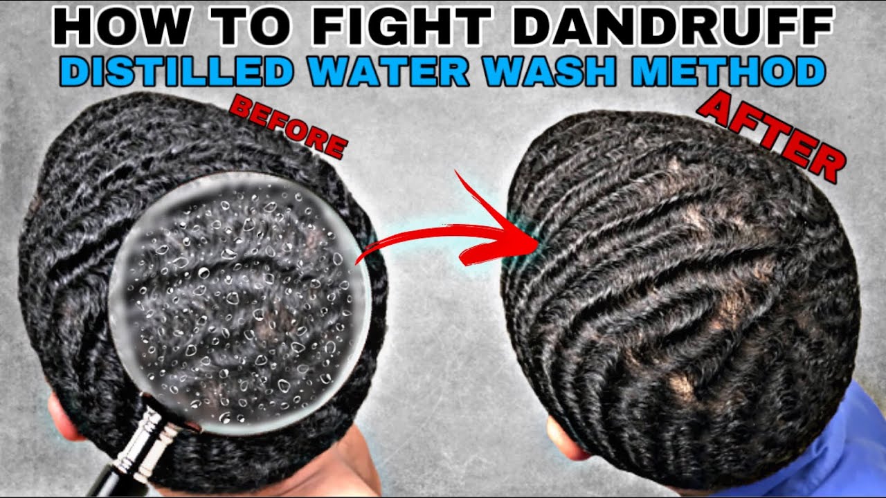 360 Waves: How To Fight Dandruff - Distilled Water Wash Method For Clarifying Your Hair
