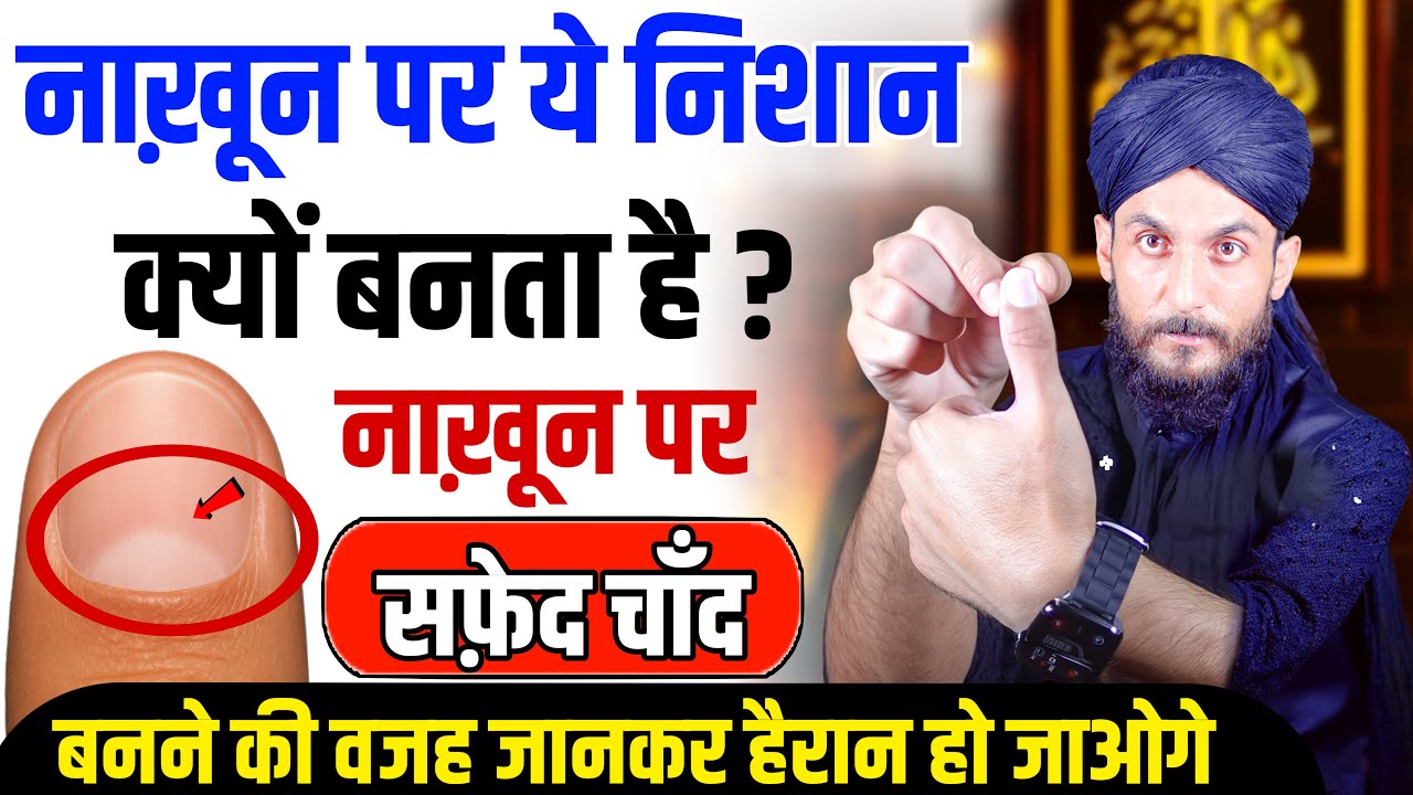 इस निशान को हल्के में मत लेना - Nakhun Par Safed Chand Kyu Banta Hai | इस्लाम में इसका मतलब GS World