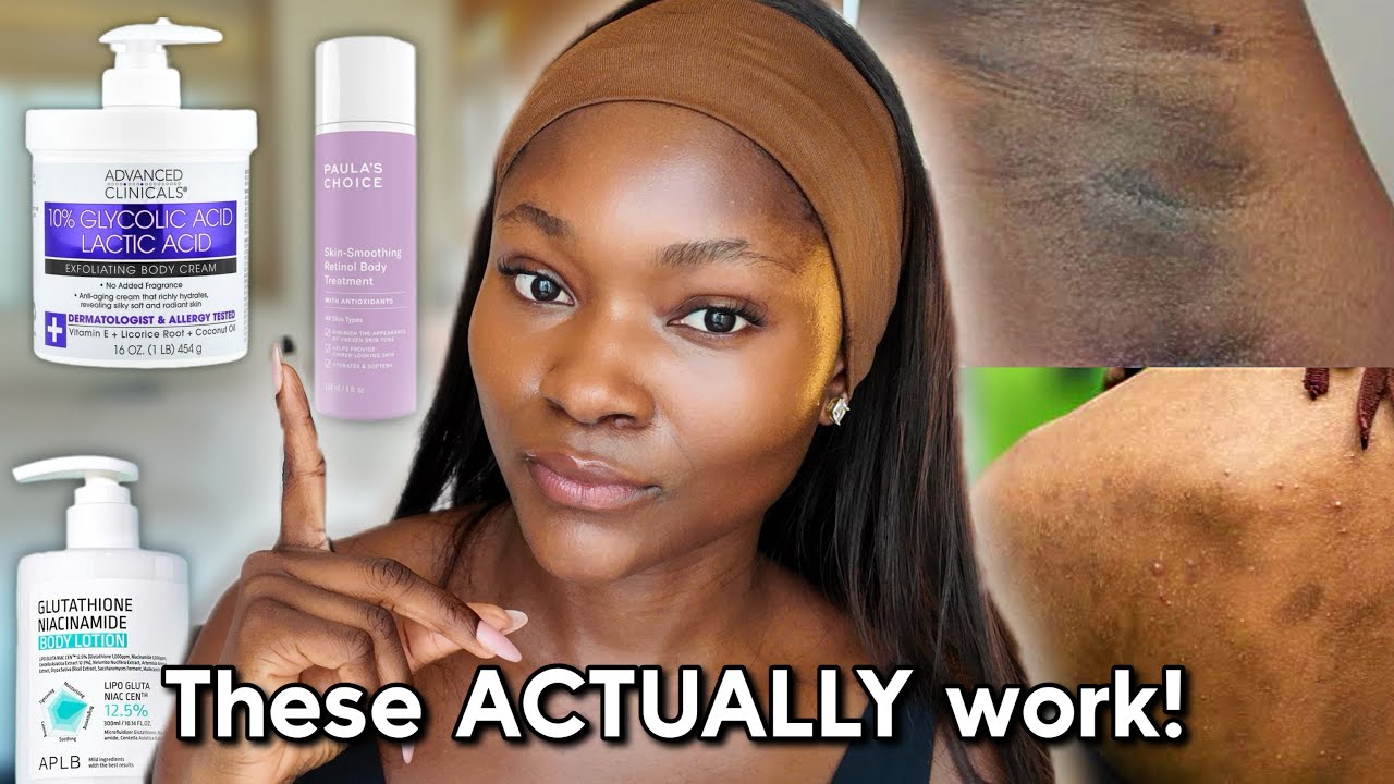Best Body Lotions for Hyperpigmentation & Body Spots | Clear, Smooth Skin Treatments