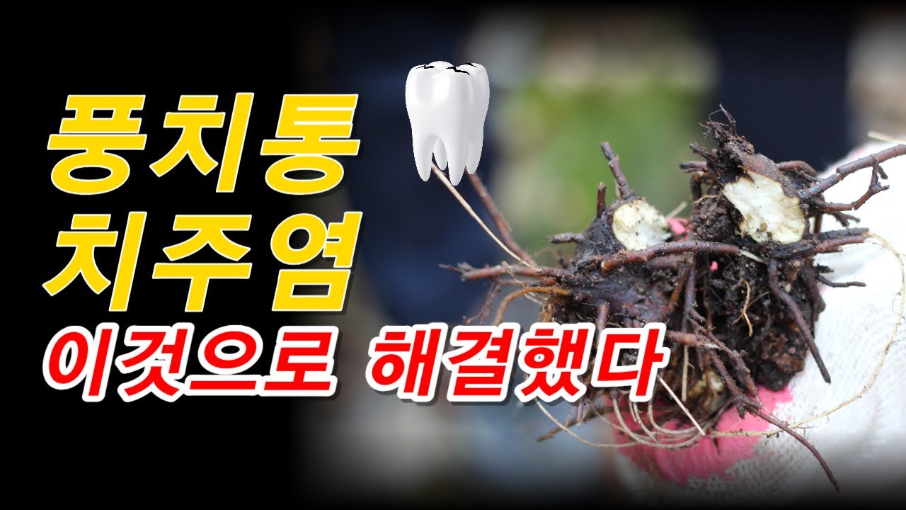 치과 가기 싫다면 이것 써보세요. 치주질환, 풍치에 효과 좋아요[약초방송]