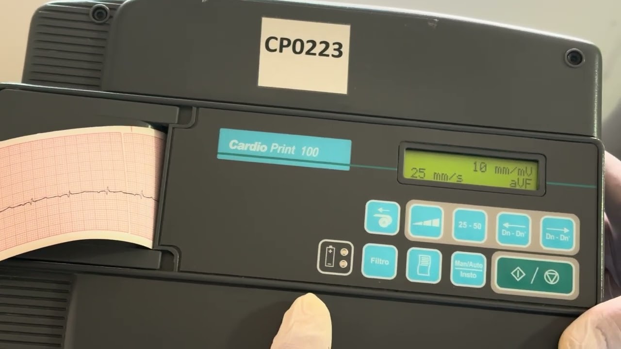 Cómo hacer un ECG (cardio print) con un solo vector 