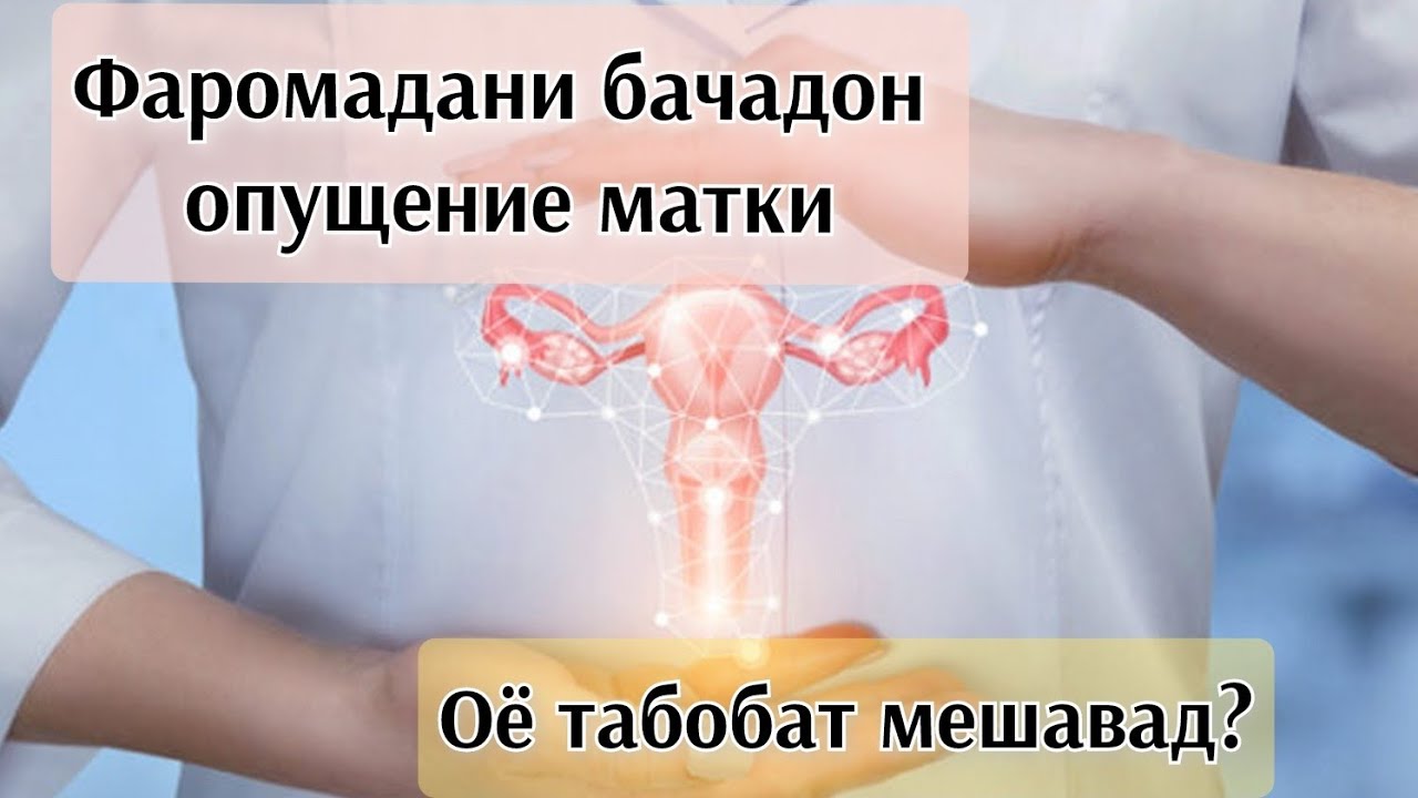 Пролапс матки. Методы профилактики и лечения #здоровыйобразжизни #пролапсматки #лечение
