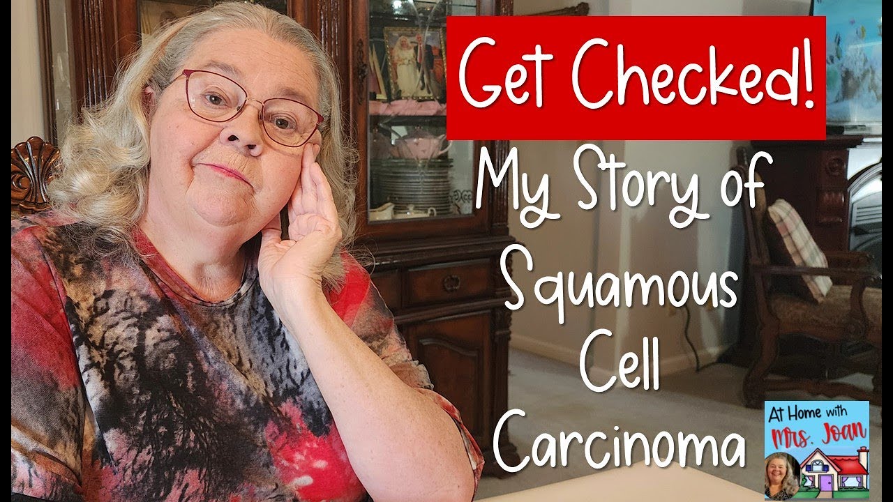 Плоскоклеточный рак кожи (моя личная история)