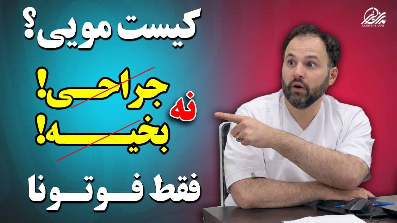 کیست مویی - درمان کیست مویی بدون جراحی