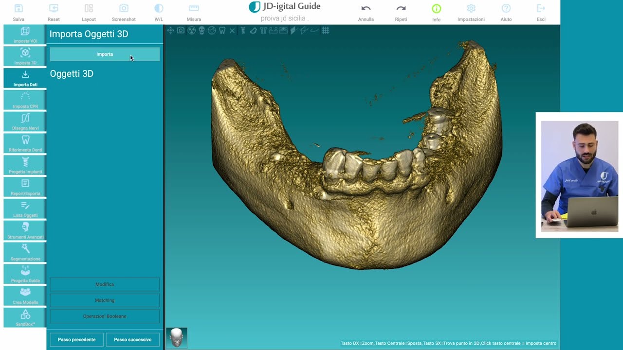 Progettazione Chirurgia Computer Guidata con Software RealGuide