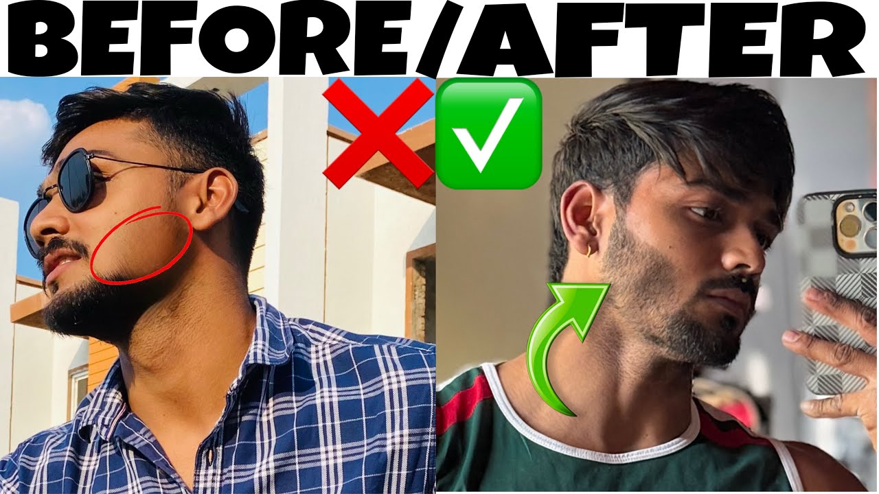Man Matters Beard Growth Kit || My Honest Review After  3months