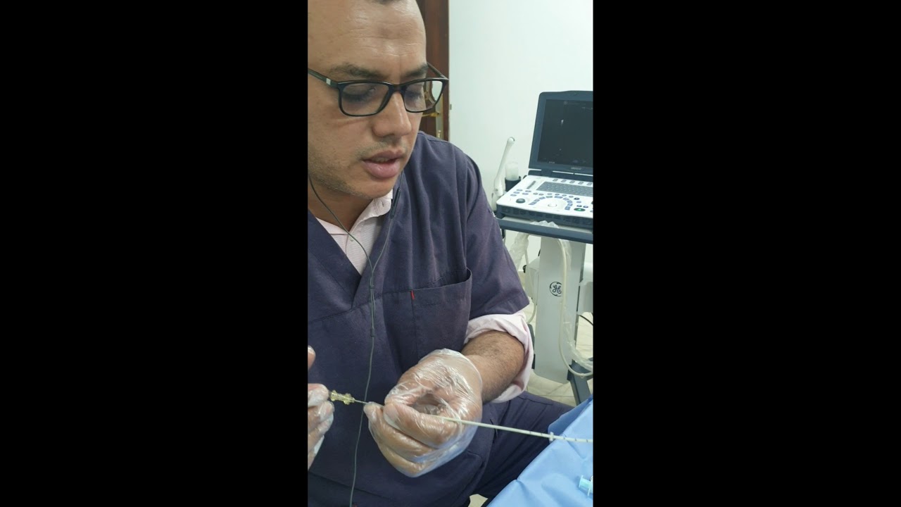Embryo transfer  catheter د محمود عبدالعاطى
