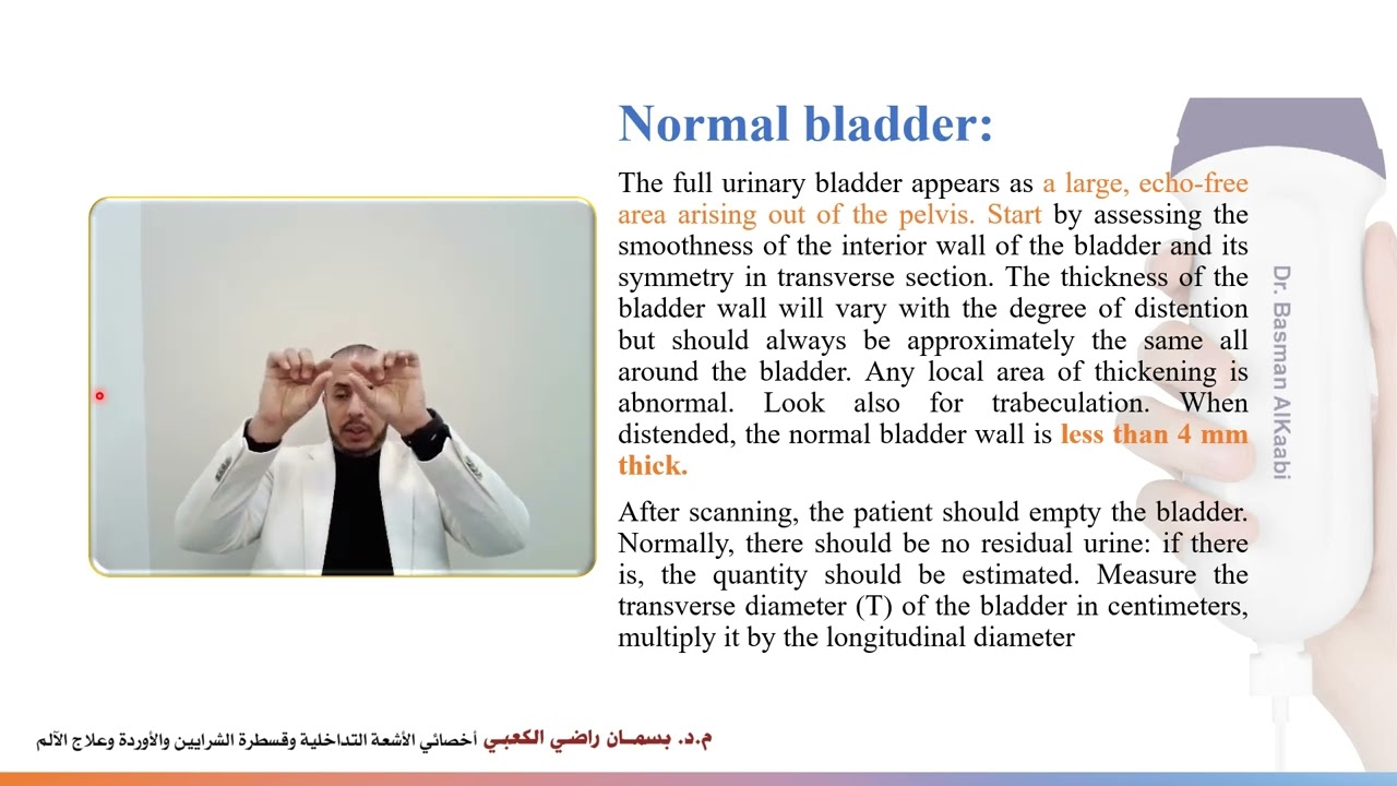lec 14 Ultrasound of urinary bladder سونار المثانه / كلية تقنيات الأشعه- المرحلة الرابعه