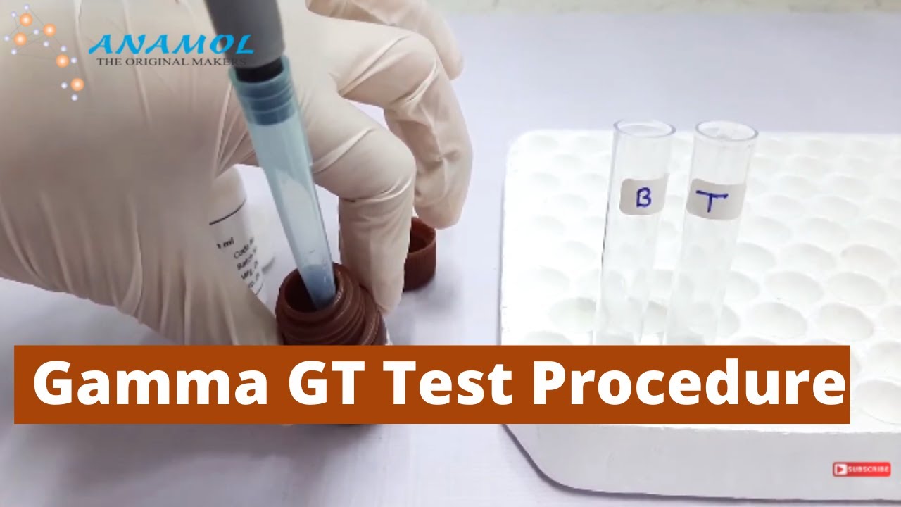Liver Function Test | Gamma GT Test Procedure