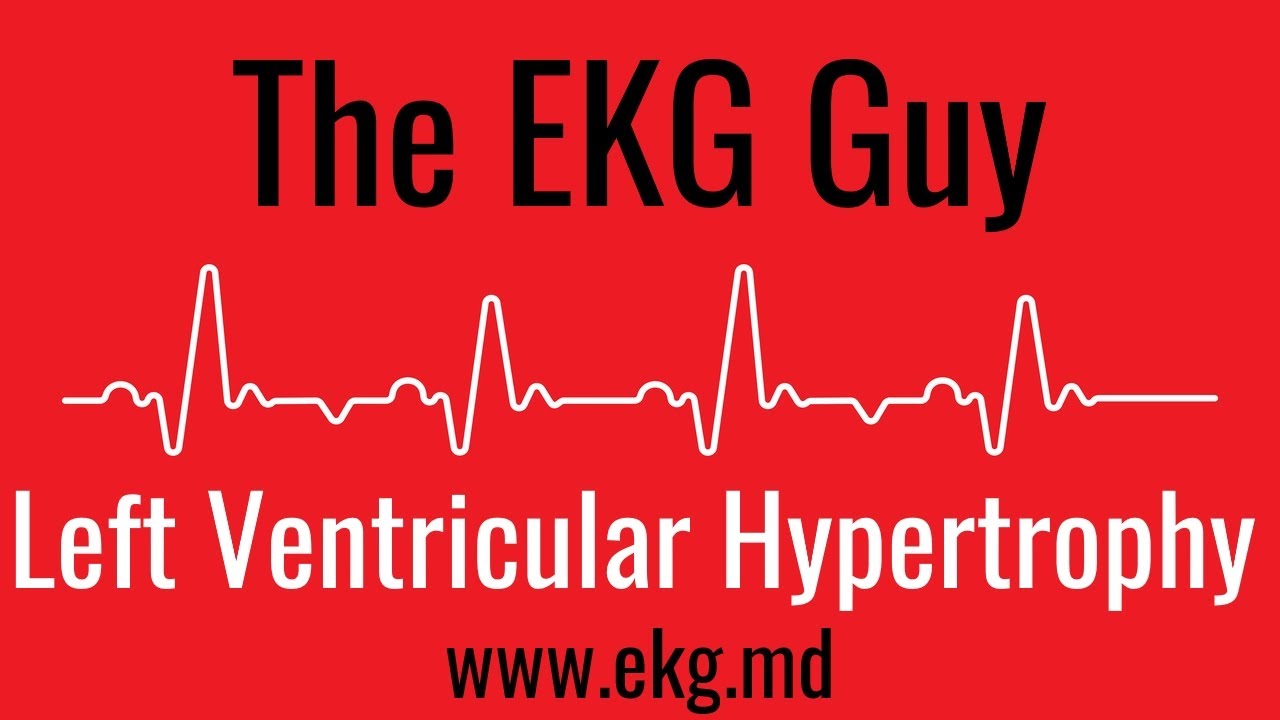 Left Ventricular Hypertrophy on EKG / ECG l The EKG Guy - www.ekg.md