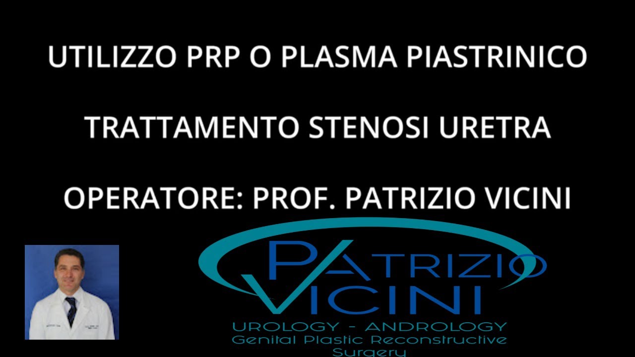 Priapus Shot-Plasma Piastrinico-Stenosi Uretrale-Uretroplastica-Patrizio Vicini-Andrologo-Andrologia