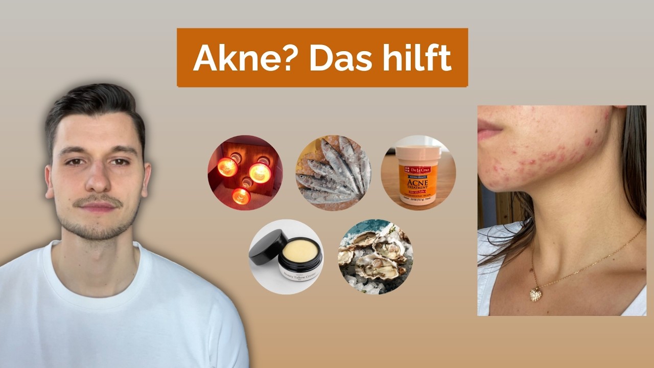 Top 5 Produkte gegen Akne, die WIRKLICH helfen!