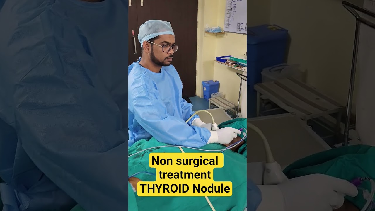 Non surgical treatment for Thyroid Nodule #microwaveablation #goitre