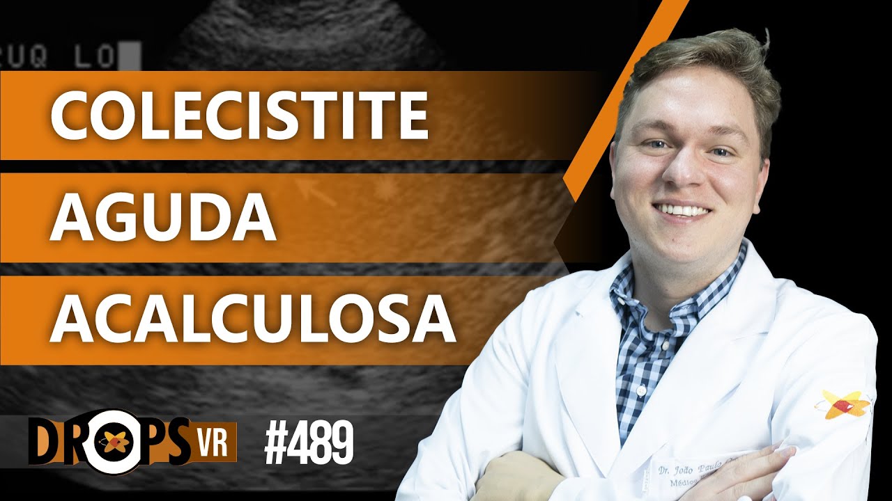 COLECISTITE AGUDA ACALCULOSA