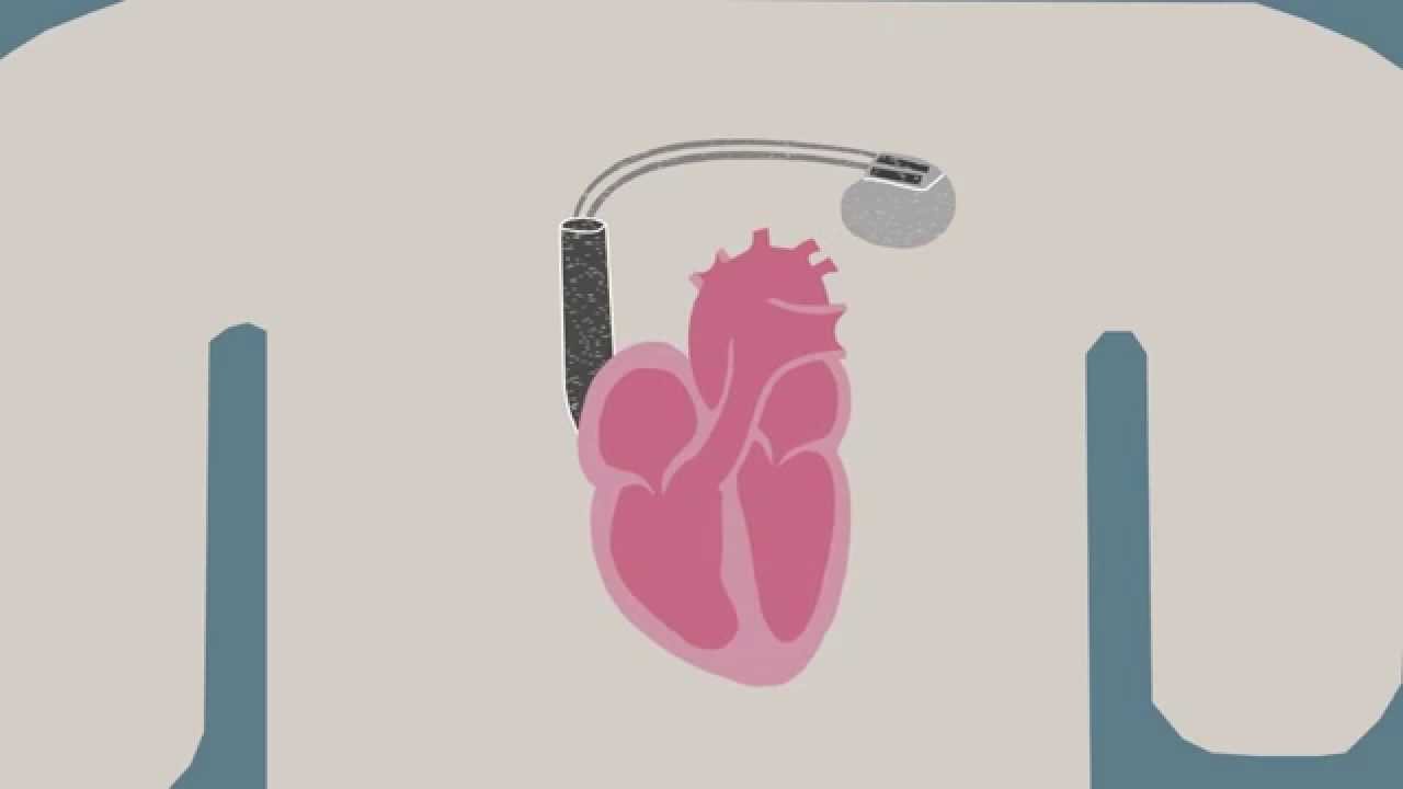 Biological Pacemaker Cells Reset Heartbeats