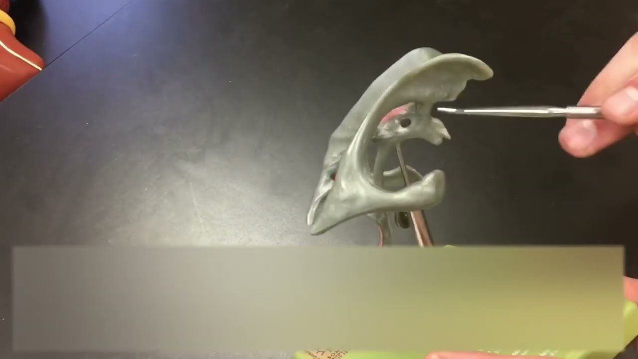 The Ventricle Model (casting of ventricles in brain)