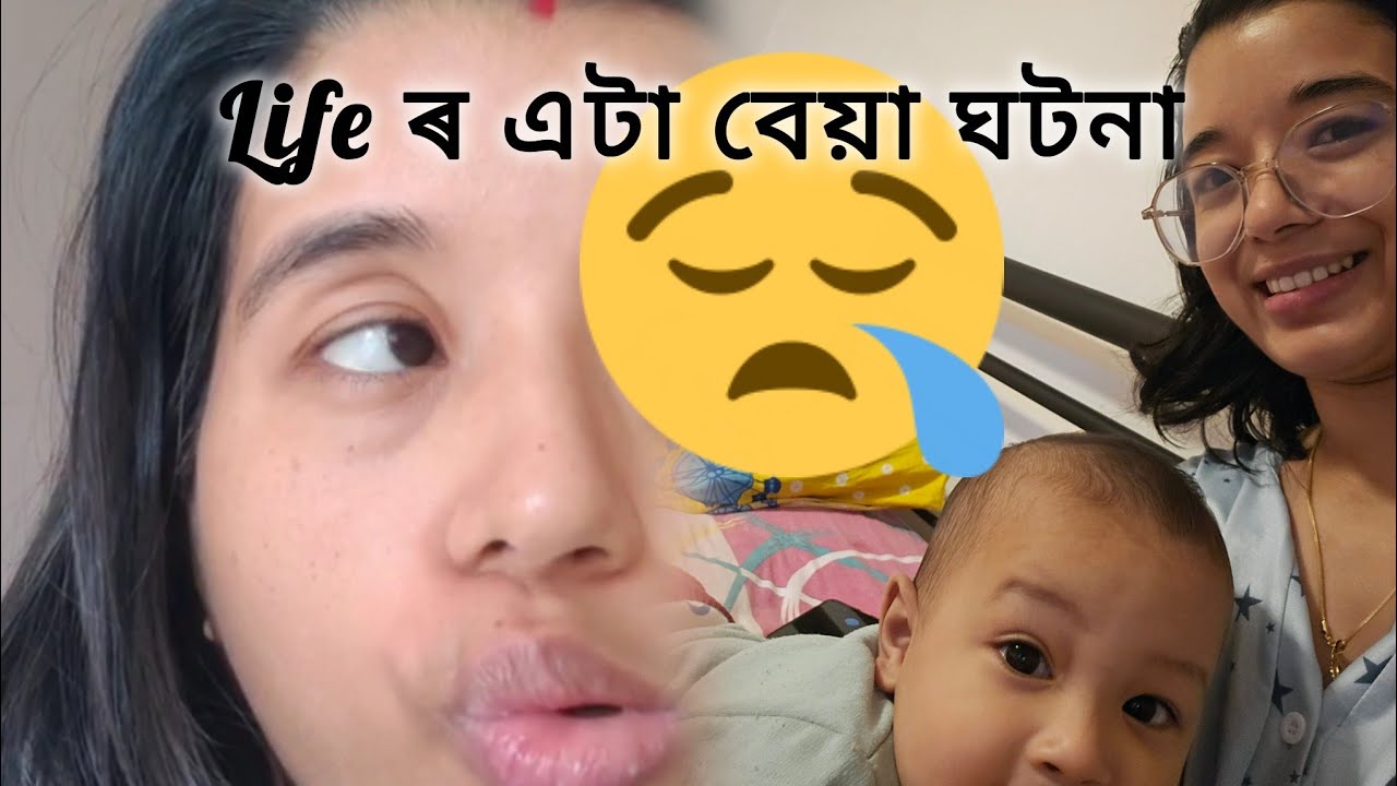 Bell's palsy এটা ভয়ংকৰ দিন|হাহি নাইকিয়া হৈছিল||#facialparalysis #bellspalsyjourney
