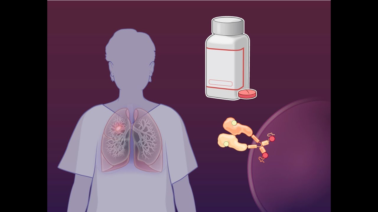 Adjuvant Osimertinib and Advanced EGFR-Mutated NSCLC | NEJM