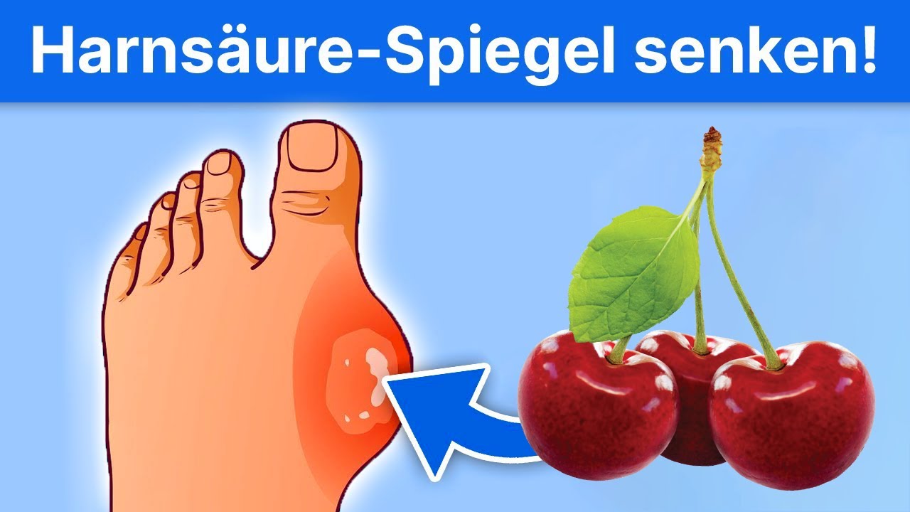 7 Lebensmittel, die deinen Harns&auml;urespiegel senken!
