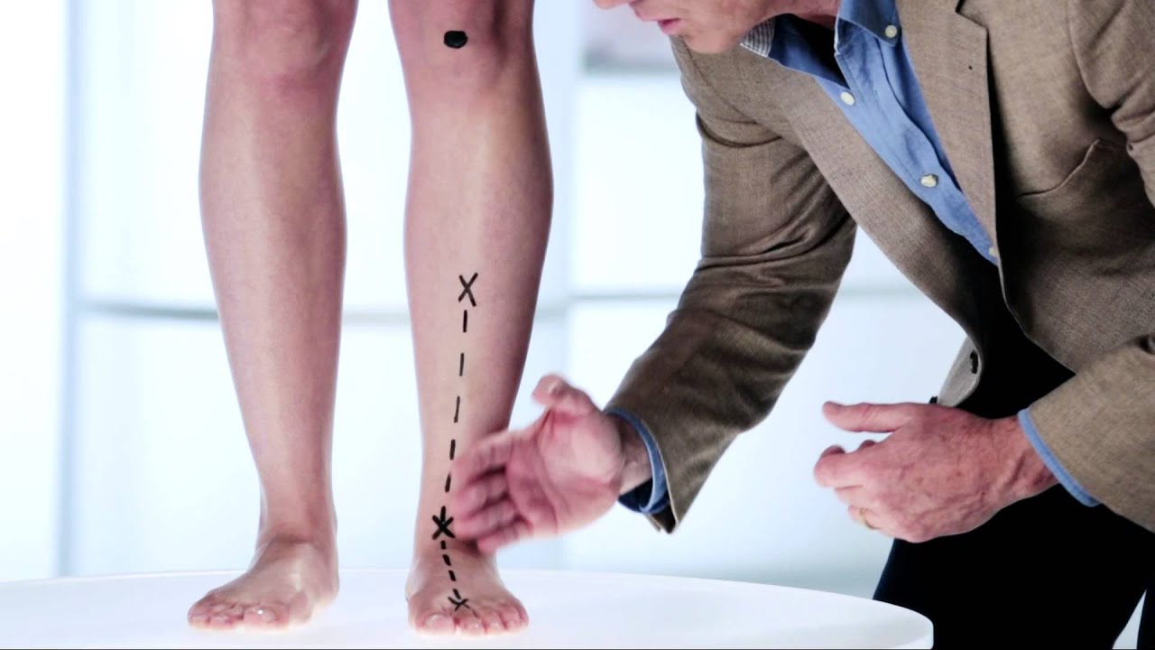 What is foot pronation?