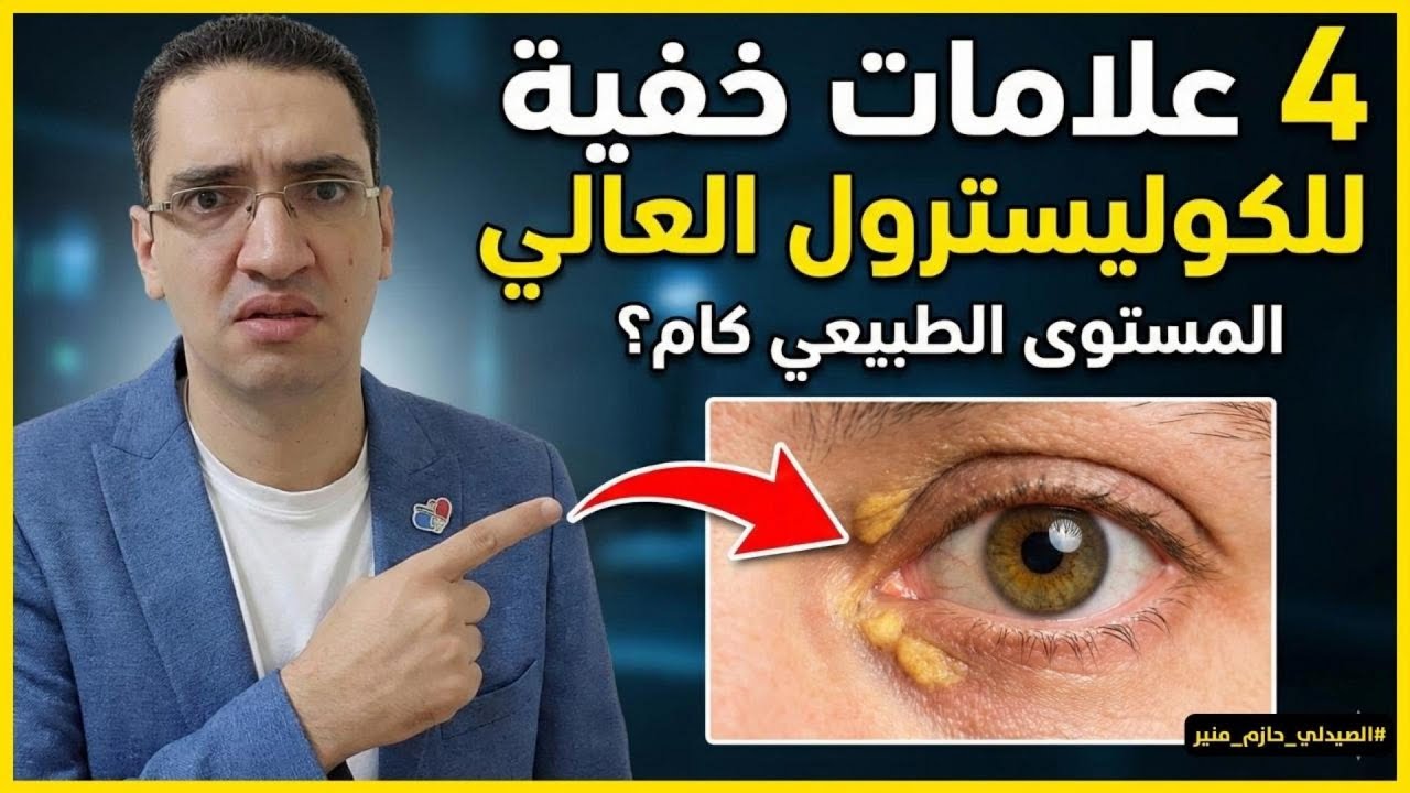 4 علامات خفية للكوليسترول العالي - كل ما تريد معرفته عن الكوليسترول والمستويات الطبيعية والخطيرة