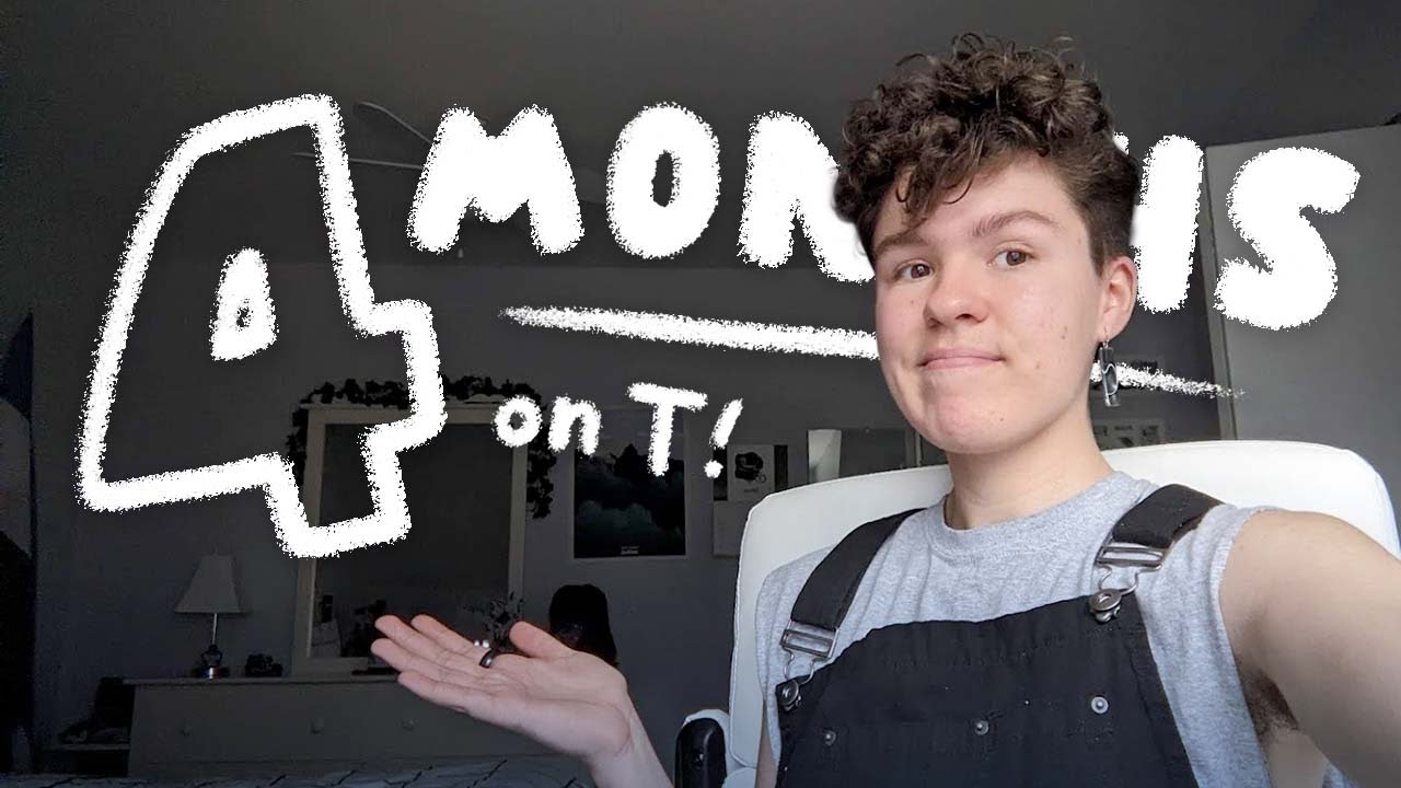 4 months on testosterone ✦ HRT updates