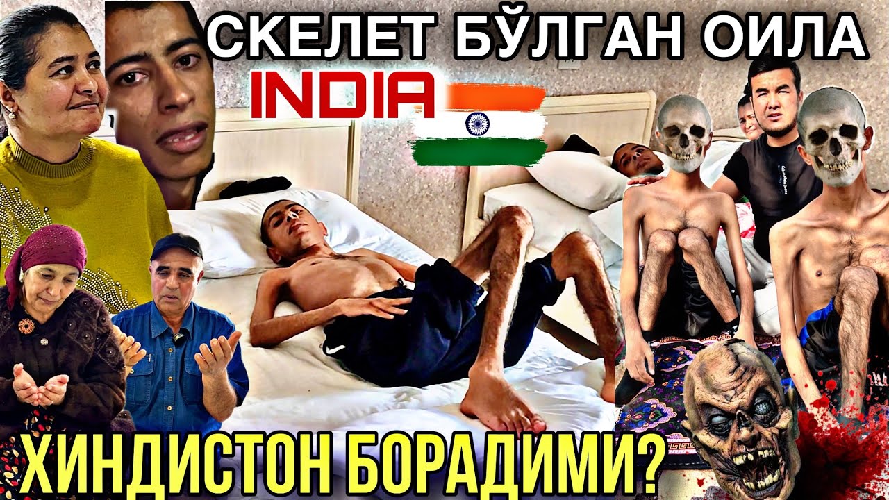 СКЕЛЕТ БЎЛИБ ҚОЛГАН ОИЛА ОҒИР АХВОЛДА ХАЁТИ ХАВФ ОСТИДА ЭДИ😱