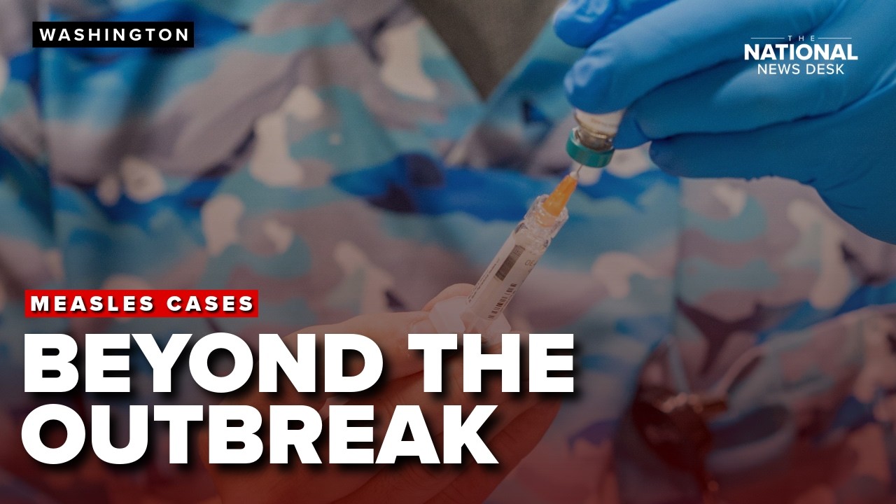 New study shifts focus in growing measles outbreaks across the US